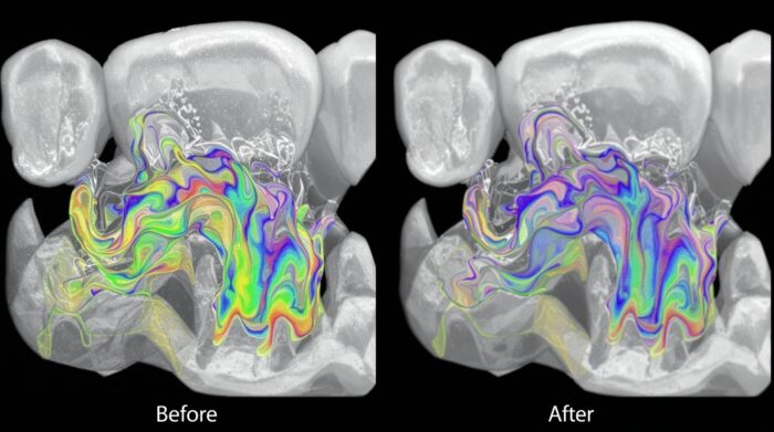3D dental reconstruction showing enhanced image quality