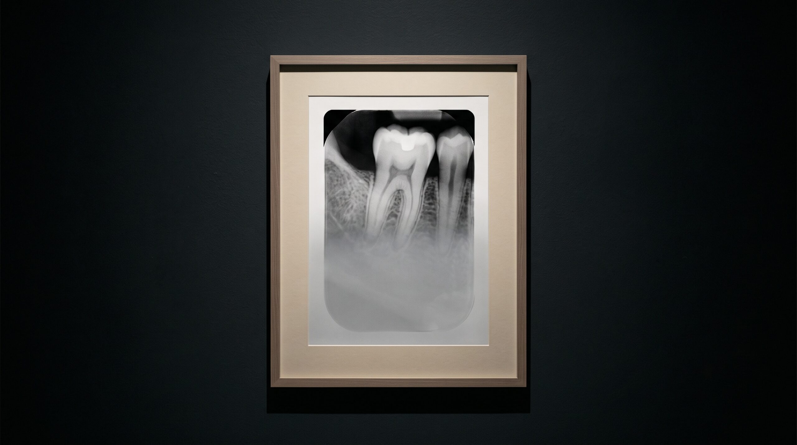 A framed dental radiograph with a soft translucent grey veil drifting over its lower half, washing out the contrast there