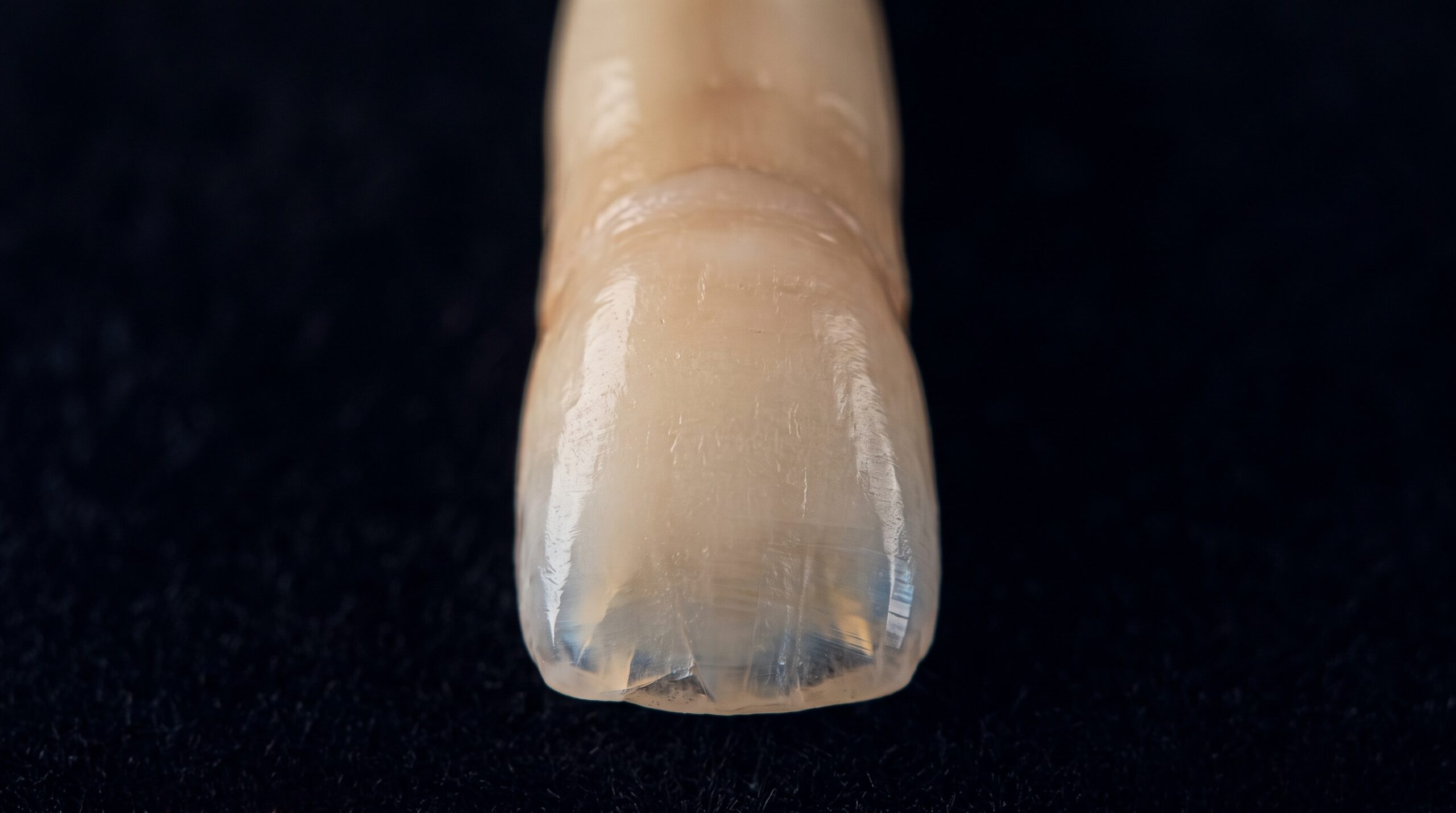 Cross-polarized macro image of an anterior tooth revealing internal translucency without surface glare