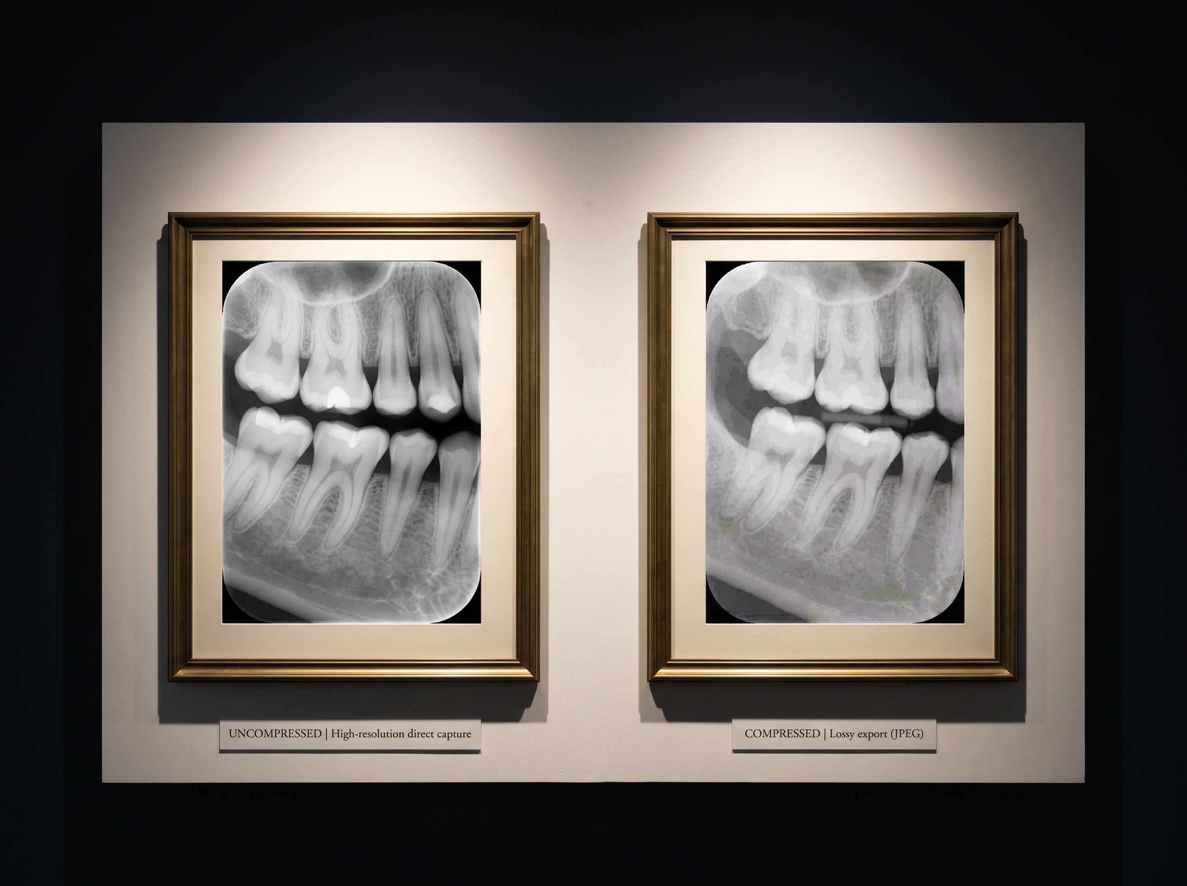 Two framed copies of the same dental radiograph - the left crisp and full-toned, the right flattened and degraded after a lossy export.