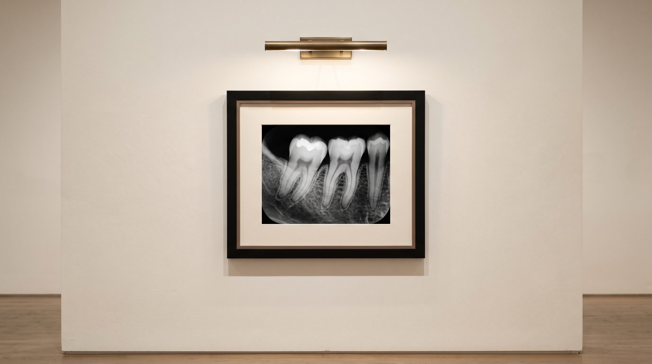 A clean, low-noise dental radiograph presented as framed fine art on a gallery wall