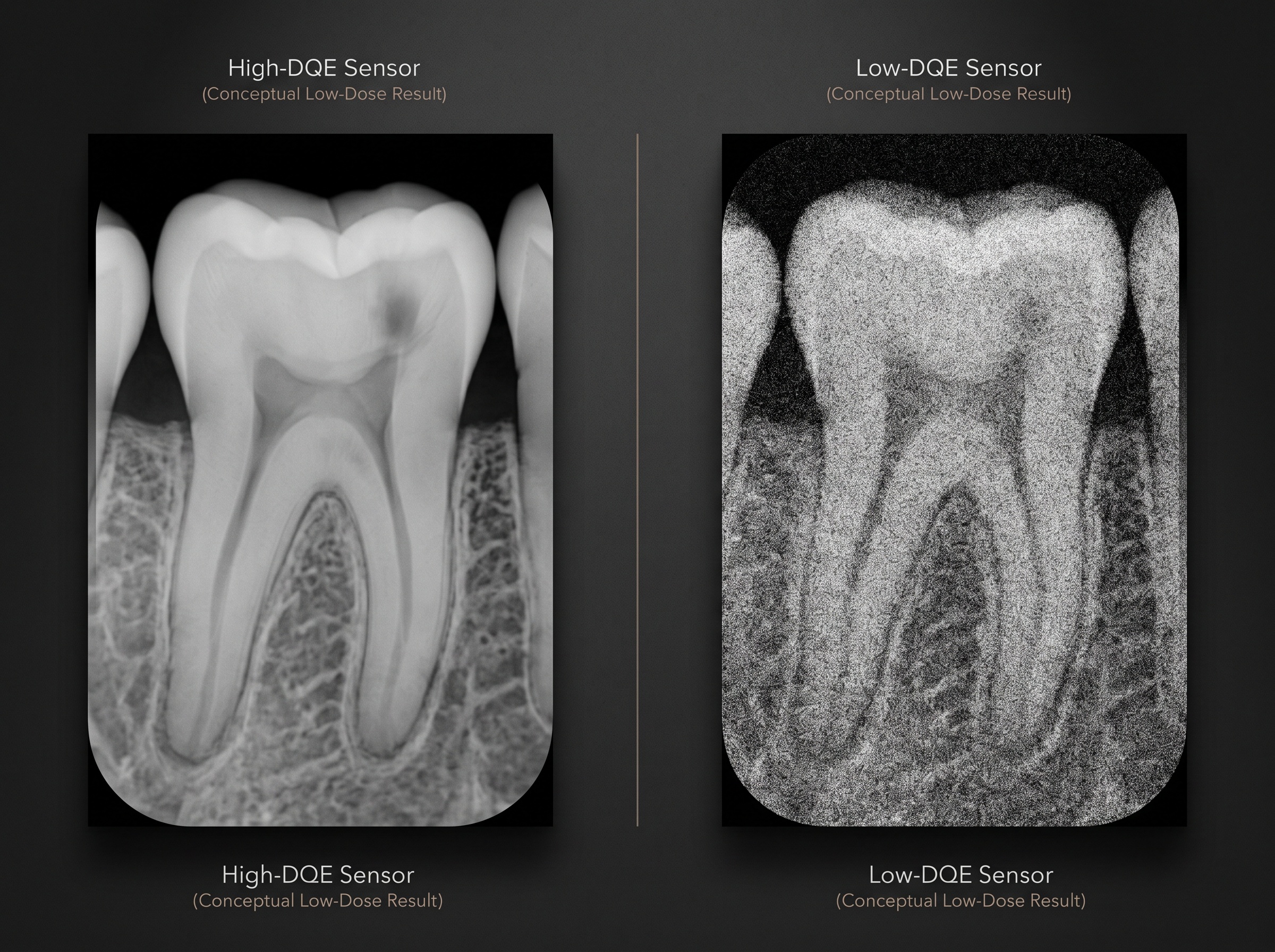 Side-by-side low-dose radiographs showing a clean high-DQE image versus a noisy low-DQE image