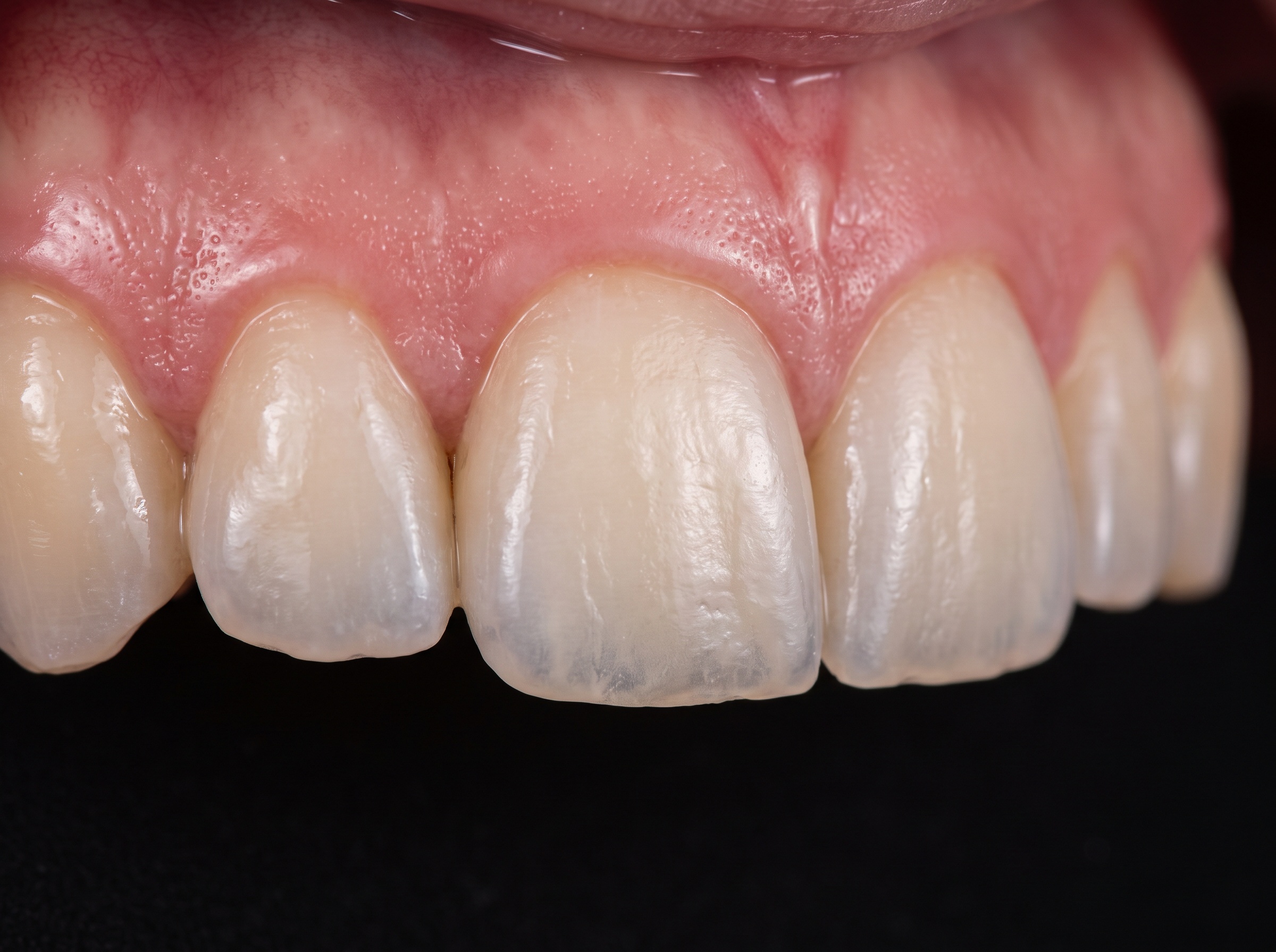 Intraoral Photography Best Practices for Treatment Documentation — detail image