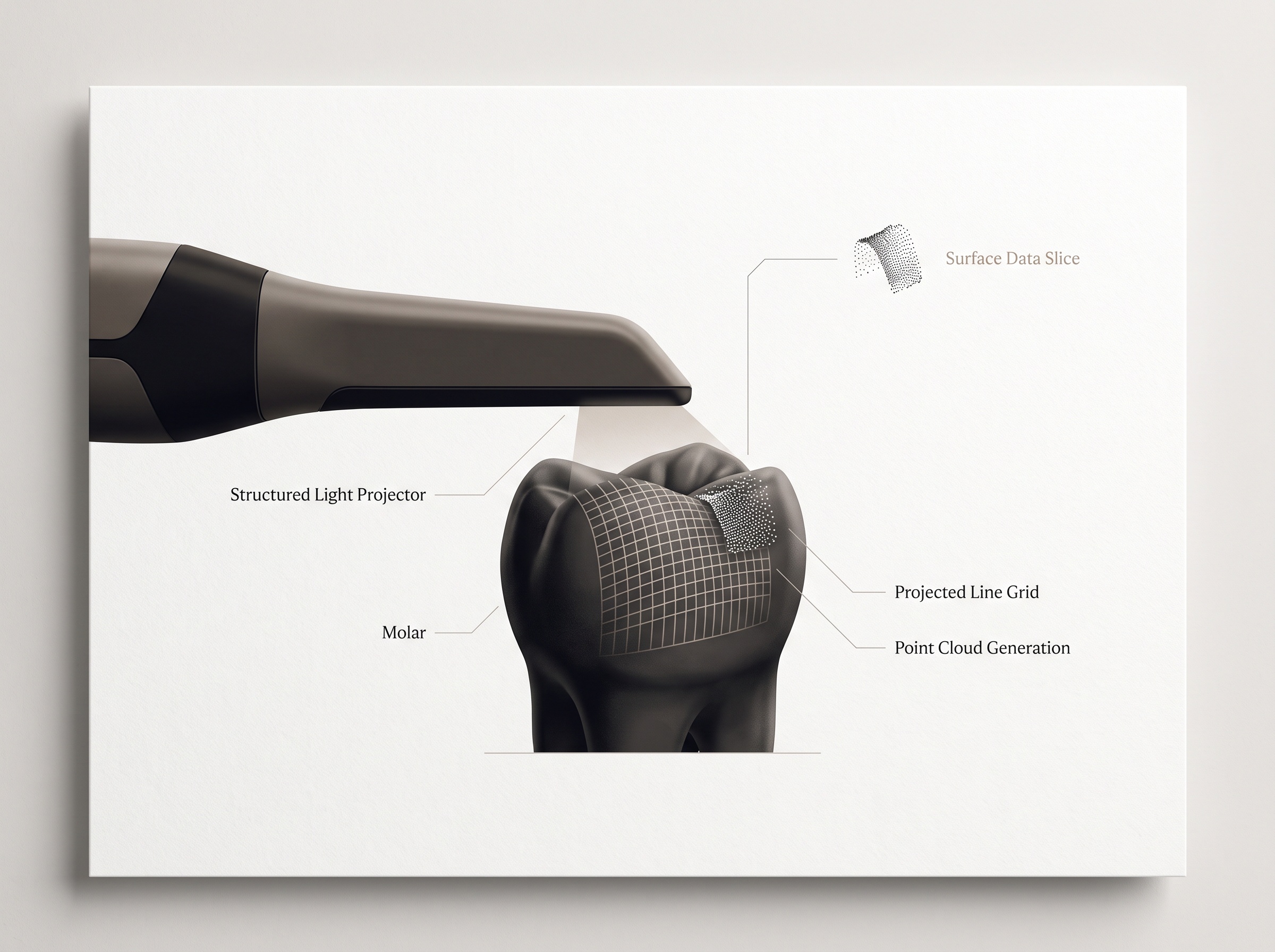 Illustration of a scanner projecting a structured light pattern onto a tooth to capture 3D points