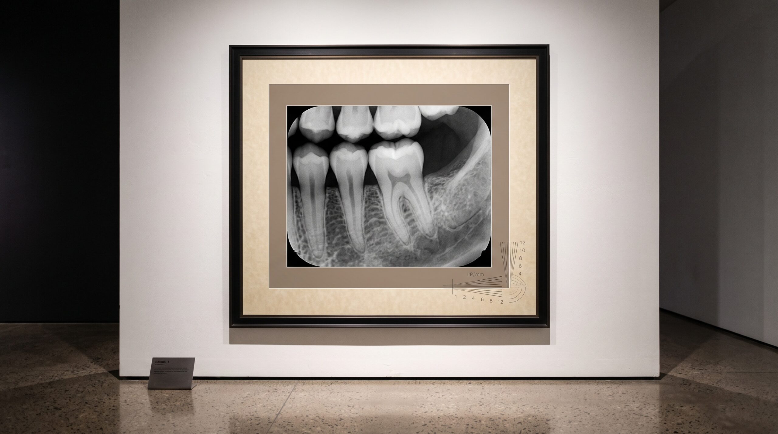 A framed dental radiograph on a gallery wall overlaid with a faint converging line-pair resolution pattern