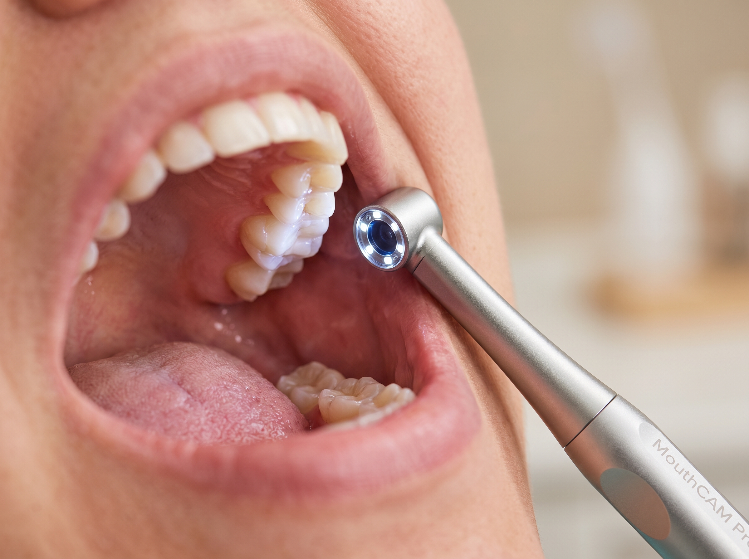 MouthCAM Pro AIoBio — detail image
