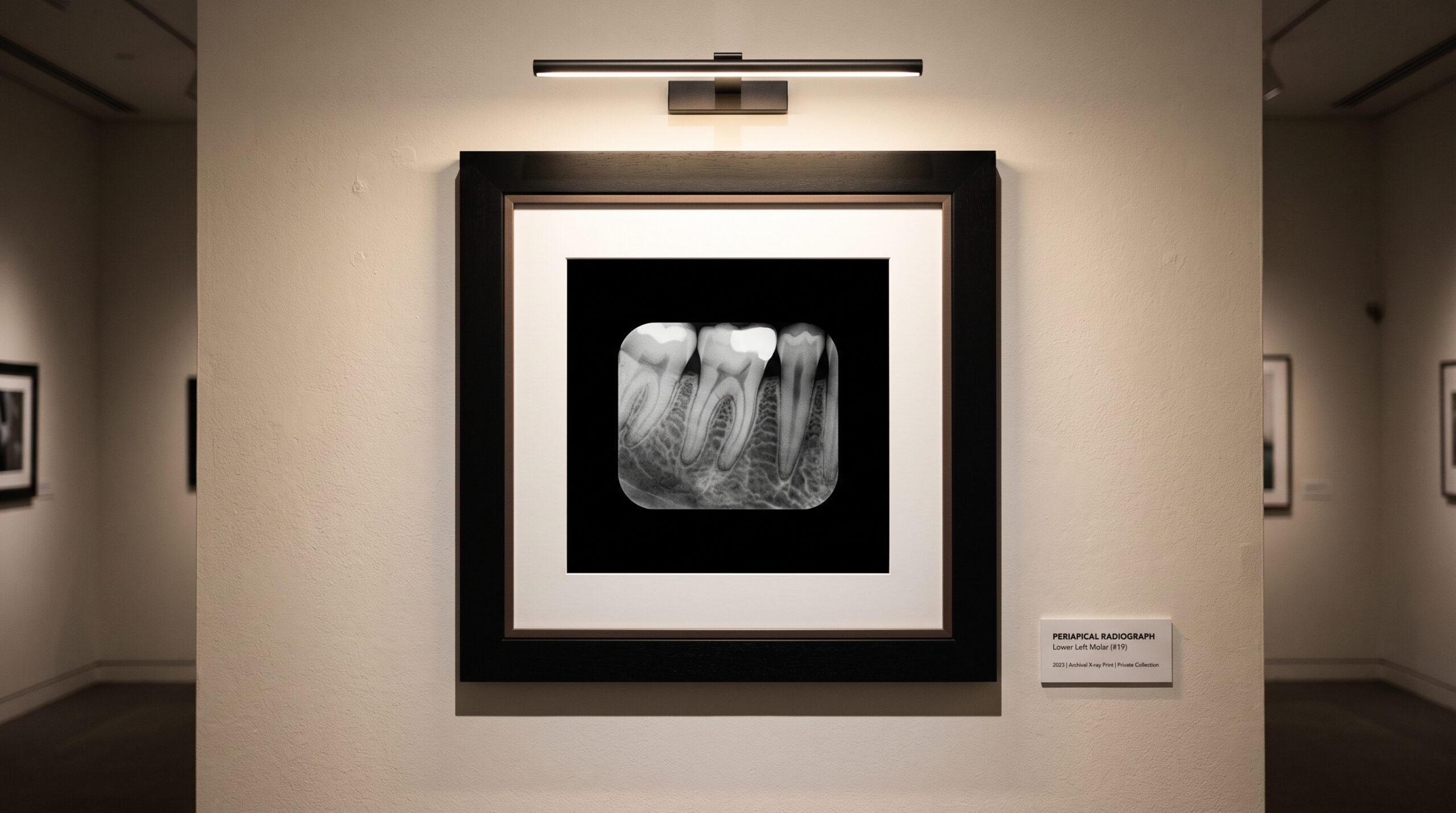 A dental radiograph presented as framed fine art on a gallery wall, its background deep true-black