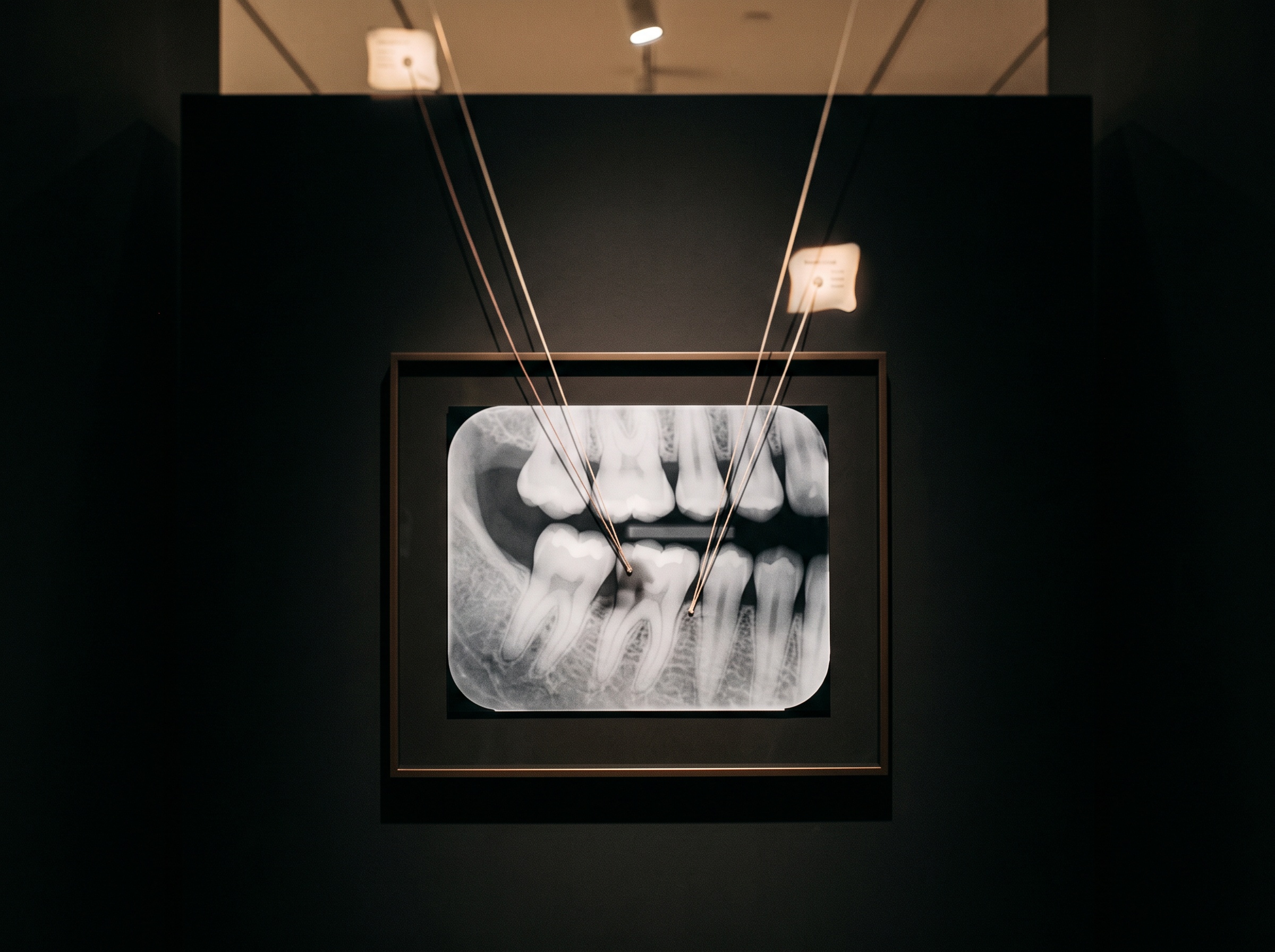 A framed bitewing radiograph with threads of light tying described findings back to precise points on the image