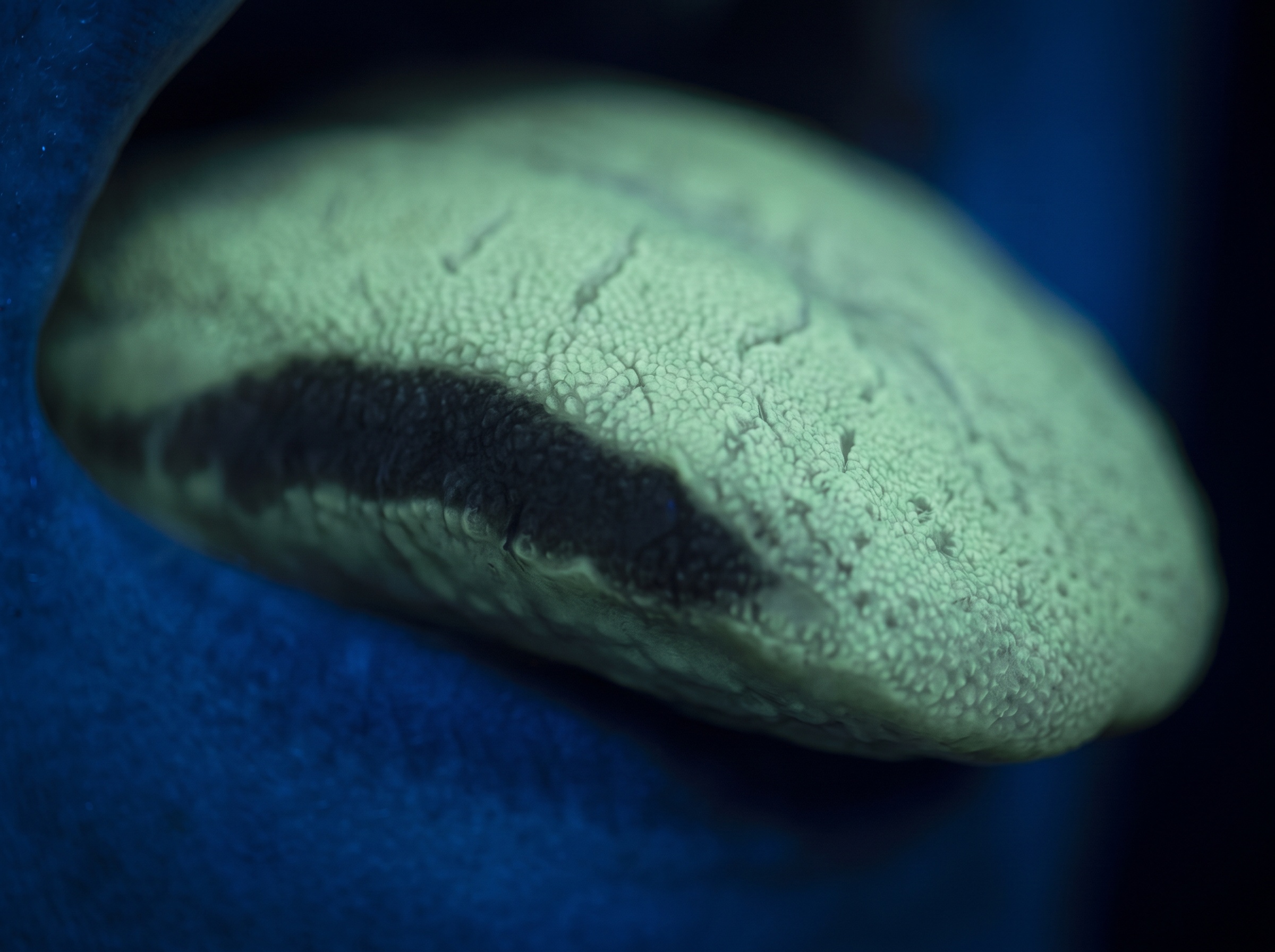 Lateral tongue border under autofluorescence with an even green glow broken by a dark demarcated band
