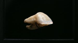 Against the Void: The Black Contrastor and the Craft of Isolating a Tooth