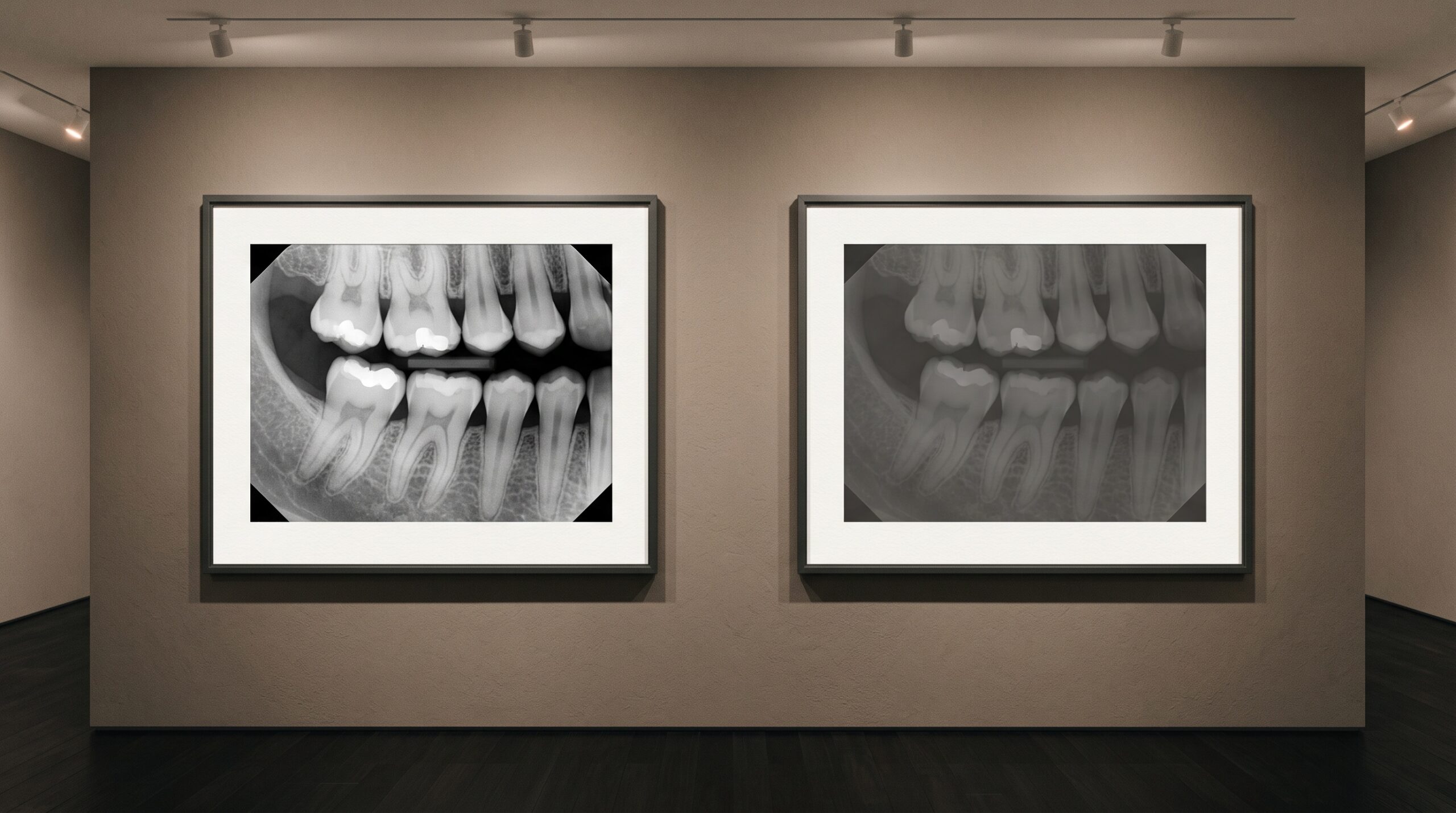 Two framed versions of the same dental radiograph on a gallery wall, one crisp and one muddy and underexposed