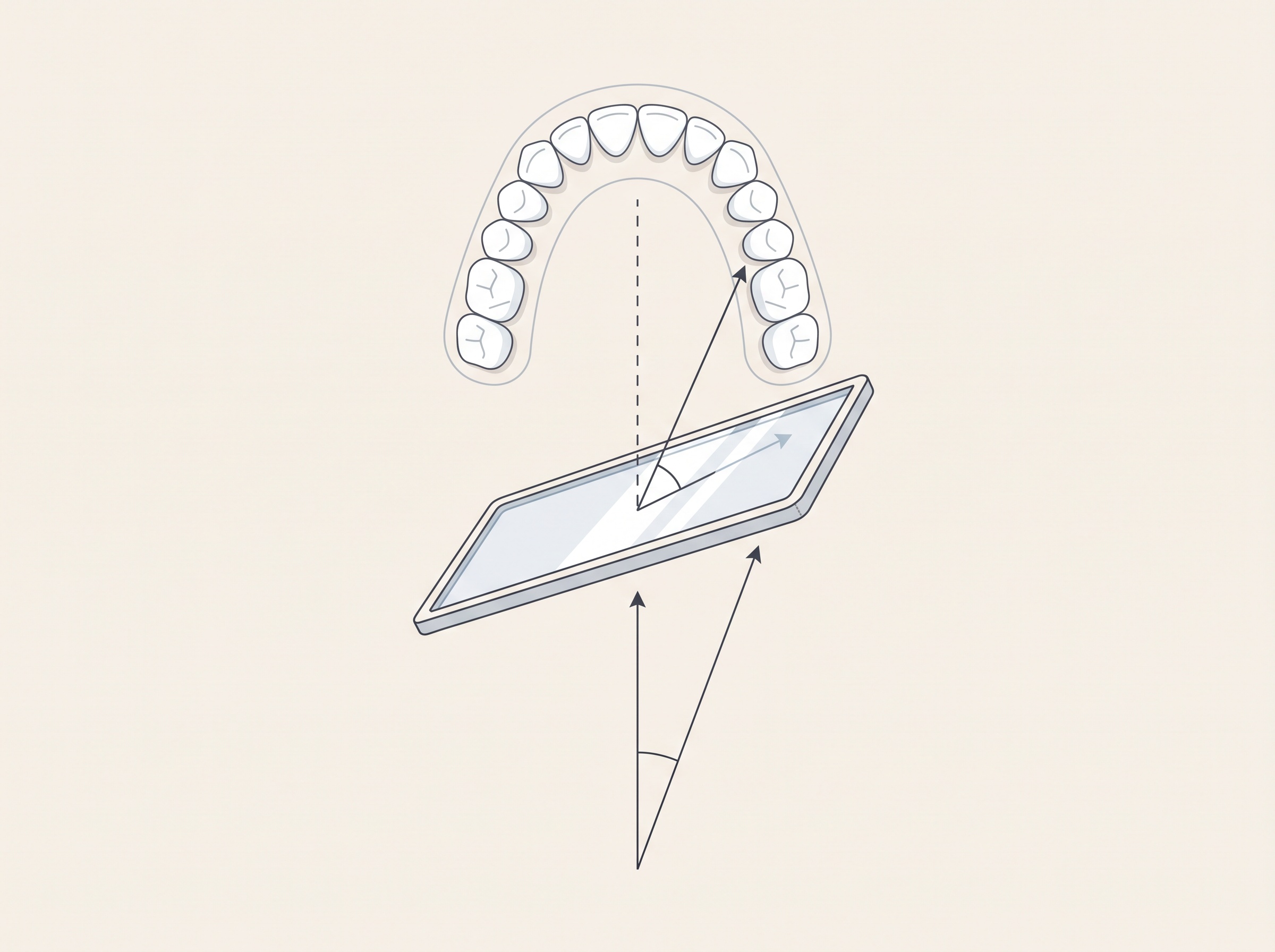 Diagram of the geometry of an occlusal mirror photograph showing camera axis and mirror angle