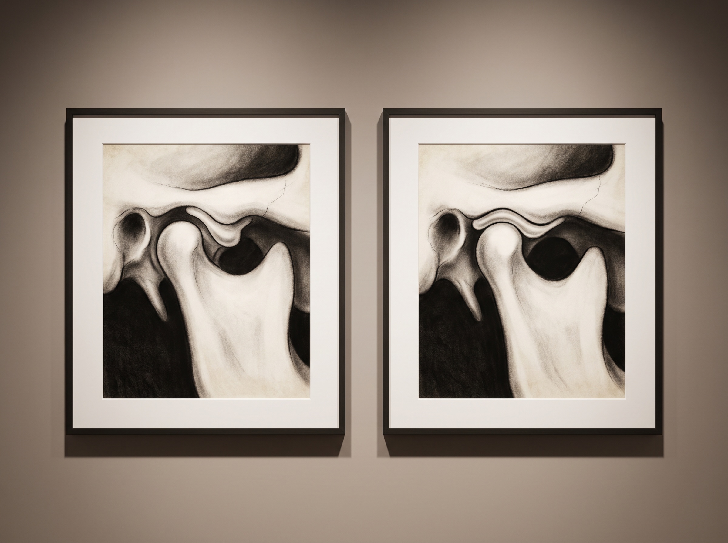 A diptych of the jaw joint closed then open, showing the condyle translating forward and the disc recapturing, as paired gallery panels