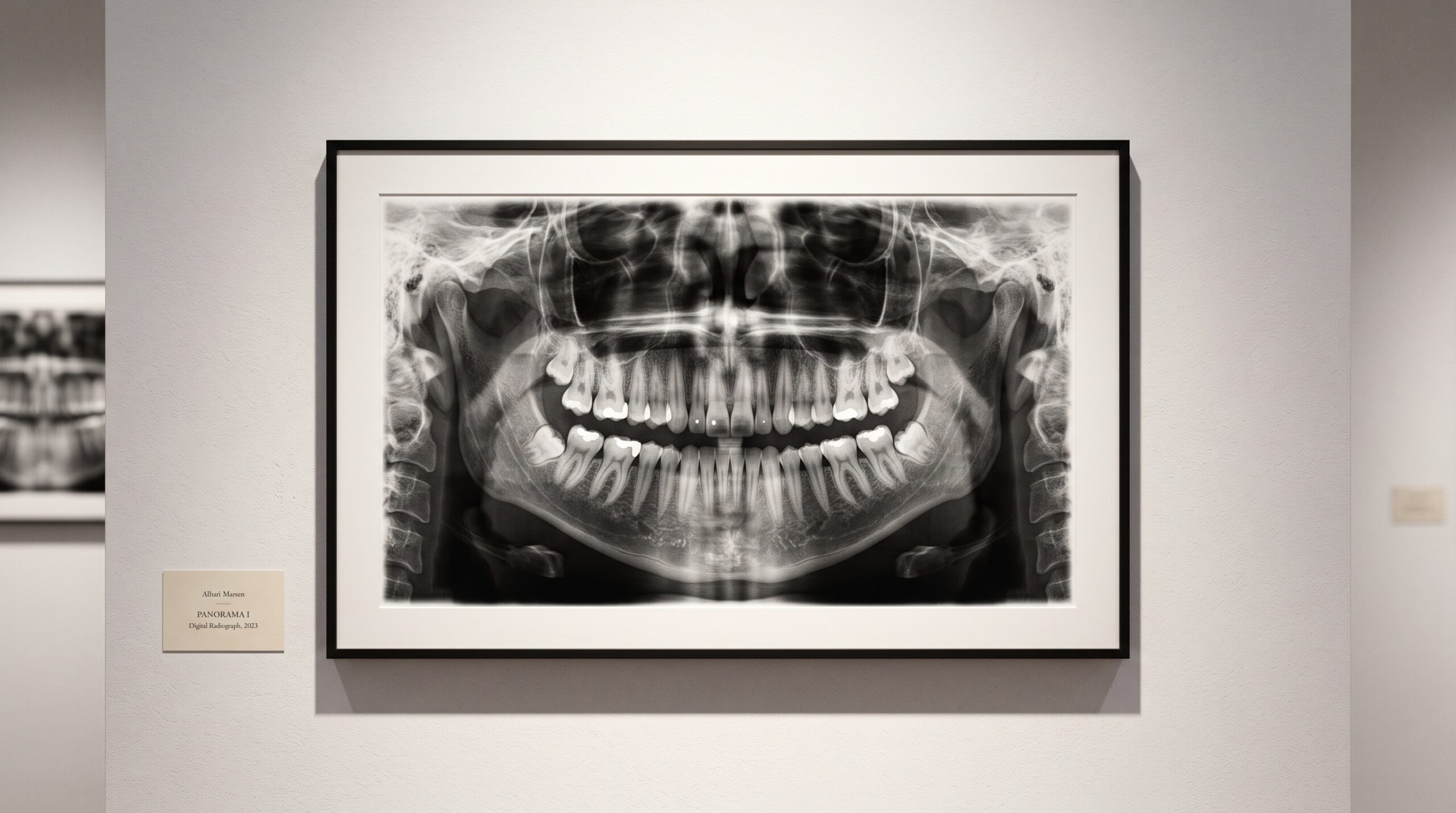 A panoramic dental radiograph framed as fine art, the frame deliberately wider than the teeth to include the surrounding anatomy