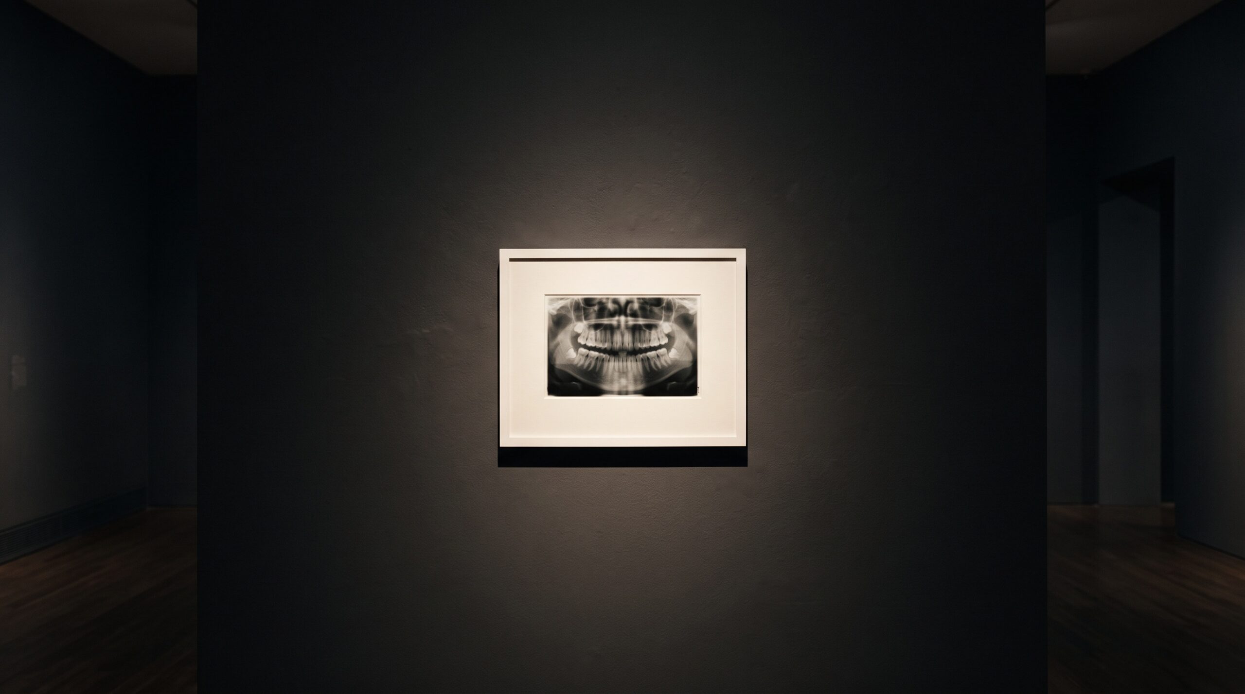 A single framed dental radiograph hung alone and centered on a vast dark gallery wall, lit by a precise pool of light, surrounded by deliberate empty space