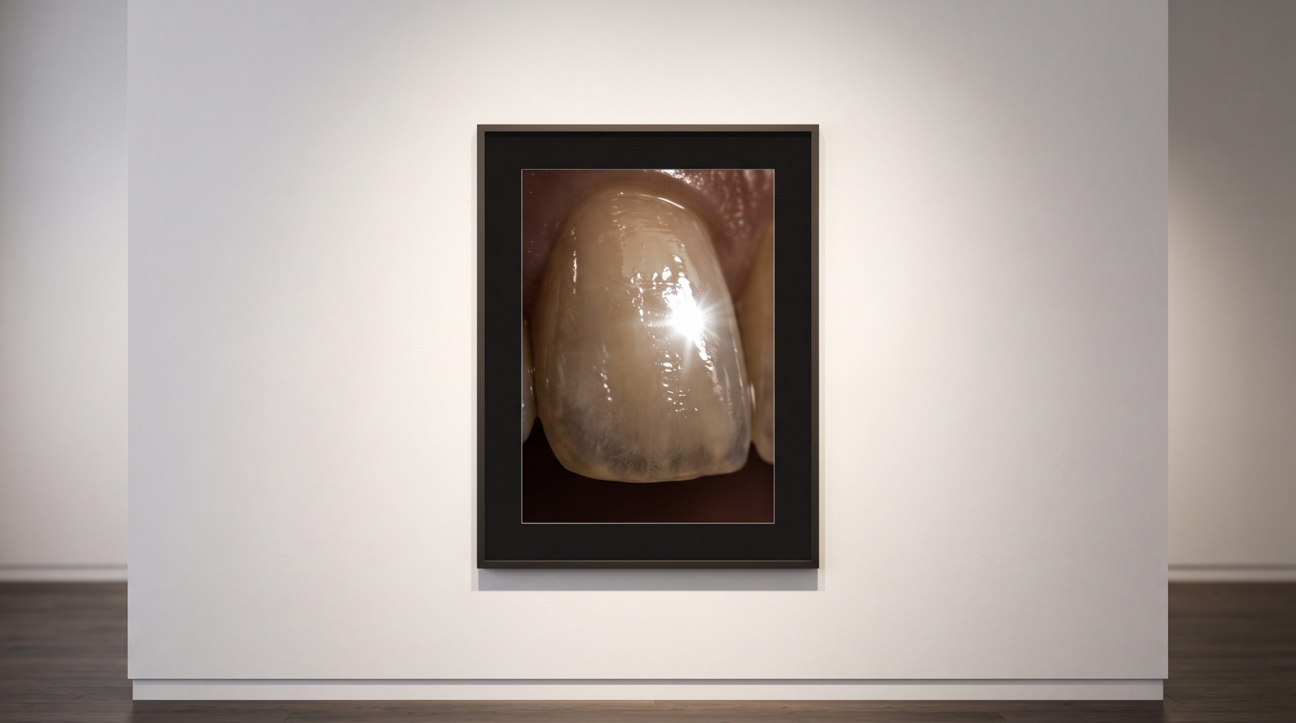 Macro photograph of a tooth with a bright specular highlight on wet enamel, framed as gallery art